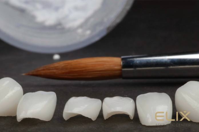 Elix Dental Lab ատամնատեխնիկական լաբորատորիա